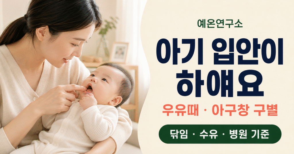 아기 입안이 하얘요 우유때 아구창 구별 닦임 수유 병원 기준 문구 오른쪽과 아기 입안을 살피는 한국인 엄마